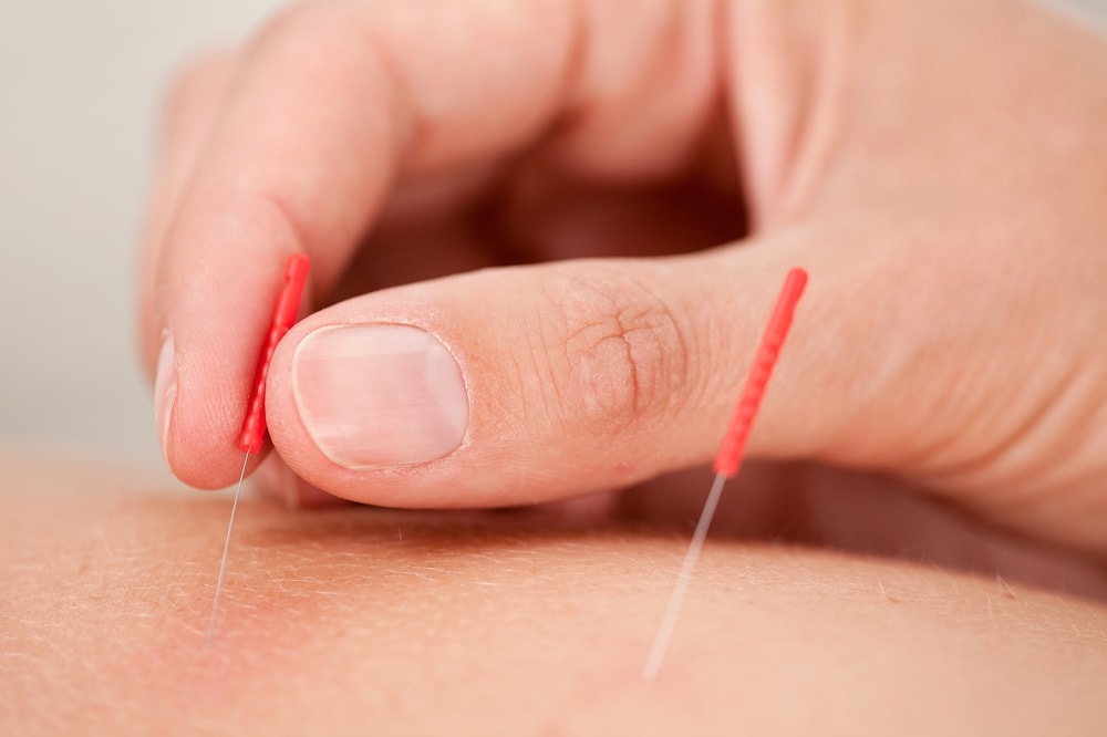Dealing with Sciatic Nerve Pain