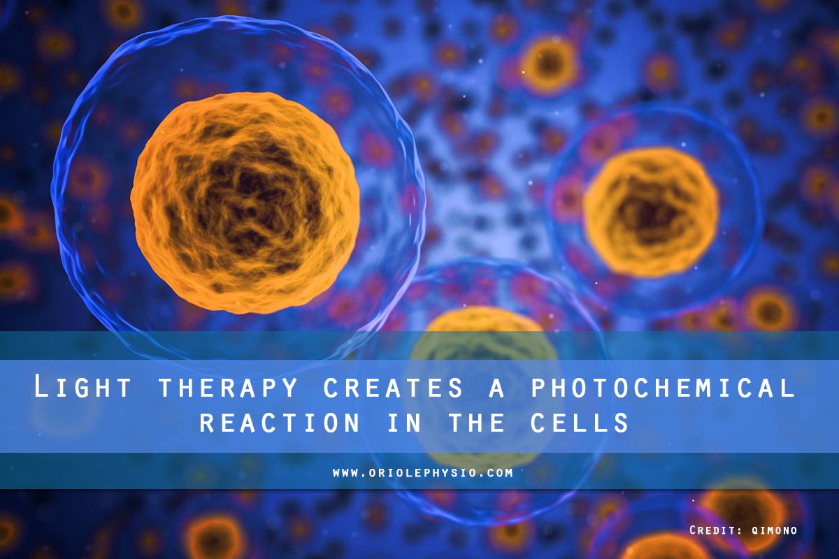 Light therapy creates a photochemical reaction in the cells