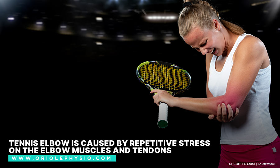 Tennis elbow is caused by repetitive stress on the elbow muscles and tendons