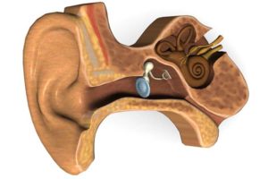 vestibular-rehabilitation1-1-300x200