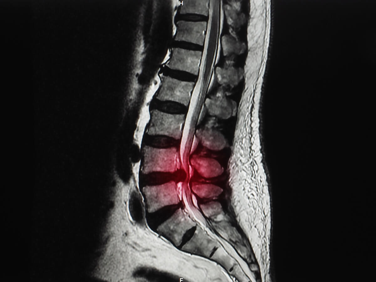Candidates-and-Contraindications